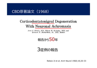 Rebeiz JJ et al. Arch Neurol 1968;18;20-33
3症例の報告
CBD原著論文（1968）
報告から50年
 