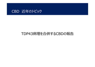 CBD 近年のトピック
TDP43病理を合併するCBDの報告
 