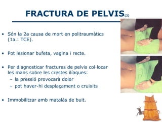 FRACTURA DE PELVIS                       (2)




• Són la 2a causa de mort en politraumàtics
  (1a.: TCE).


• Pot lesionar bufeta, vagina i recte.


• Per diagnosticar fractures de pelvis col·locar
  les mans sobre les crestes ilíaques:
   – la pressió provocarà dolor
   – pot haver-hi desplaçament o cruixits


• Immobilitzar amb matalàs de buit.
 