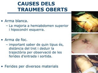 CAUSES DELS
         TRAUMES OBERTS

• Arma blanca.
  – La majoria a hemiabdomen superior
    i hipocondri esquerra.


• Arma de foc.
  – important saber de quin tipus és,
    distància del tret i deduir la
    trajectòria per observació de les
    ferides d’entrada i sortida.


• Ferides per diversos materials
 