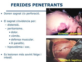 FERIDES PENETRANTS
• Donen sagnat i/o perforació.


• El sagnat s’evidencia per:
   – distensió.
   – peritonisme.
      • dolor.
      • vòmits.
      • defensa muscular.
      • íli paralític.
   – hipovolèmia i xoc.

• Es lesionen més sovint fetge i
  intestí.
 