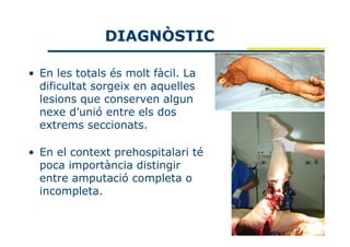 DIAGNÒSTIC

• En les totals és molt fàcil. La
  dificultat sorgeix en aquelles
  lesions que conserven algun
  nexe d’unió entre els dos
  extrems seccionats.

• En el context prehospitalari té
  poca importància distingir
  entre amputació completa o
  incompleta.
 