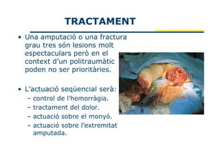TRACTAMENT
• Una amputació o una fractura
  grau tres són lesions molt
  espectaculars però en el
  context d’un politraumàtic
  poden no ser prioritàries.

• L’actuació seqüencial serà:
  –   control de l’hemorràgia.
  –   tractament del dolor.
  –   actuació sobre el monyó.
  –   actuació sobre l’extremitat
      amputada.
 
