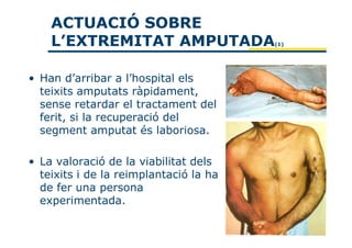 ACTUACIÓ SOBRE
    L’EXTREMITAT AMPUTADA               (1)




• Han d’arribar a l’hospital els
  teixits amputats ràpidament,
  sense retardar el tractament del
  ferit, si la recuperació del
  segment amputat és laboriosa.

• La valoració de la viabilitat dels
  teixits i de la reimplantació la ha
  de fer una persona
  experimentada.
 