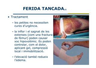 FERIDA TANCADA           (2)




• Tractament
  – les petites no necessiten
    cures d’urgència.

  – la inflor i el sagnat de les
    extenses (com una fractura
    de fèmur) poden causar
    xoc hipovolèmic. Es poden
    controlar, com el dolor,
    aplicant gel, compressió
    local i immobilització.

  – l’elevació també redueix
    l’edema.
 
