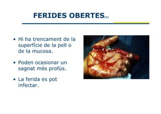 FERIDES OBERTES     (1)




• Hi ha trencament de la
  superfície de la pell o
  de la mucosa.

• Poden ocasionar un
  sagnat més profús.

• La ferida es pot
  infectar.
 