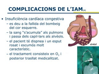 COMPLICACIONS DE L’IAM                  (4)




• Insuficiència cardíaca congestiva
  – es deu a la fallida del bombeig
    del cor esquerre.
  – la sang “s’acumula” als pulmons
    i passa dels capil·lars als alvèols.
  – el pacient té dispnea i un esput
    rosat i escumós molt
    característic.
  – el tractament consisteix en O2 i
    posterior trasllat medicalitzat.
 