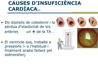 CAUSES D’INSUFICIÈNCIA
    CARDÍACA          (1)




• Els dipòsits de colesterol i la
  pèrdua d’elasticitat de les
  artèries     un  de la TA .

• El ventricle esq. treballa a
  pressions > a l’habitual i
  finalment acaba fallant pel
  sobreesforç.
 