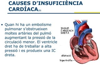 CAUSES D’INSUFICIÈNCIA
    CARDÍACA         (2)




• Quan hi ha un embolisme
  pulmonar s’obstrueixen
  moltes artèries del pulmó
  augmentant la pressió de la
  circulació menor. El ventricle
  dret ha de treballar a alta
  pressió i es produeix una IC
  dreta.
 