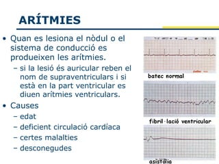 ARÍTMIES
• Quan es lesiona el nòdul o el
  sistema de conducció es
  produeixen les arítmies.
  – si la lesió és auricular reben el
    nom de supraventriculars i si
    està en la part ventricular es
    diuen arítmies ventriculars.
• Causes
  – edat
  – deficient circulació cardíaca
  – certes malalties
  – desconegudes
 