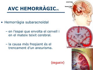 AVC HEMORRÀGIC                   (4)




• Hemorràgia subaracnoïdal

  – en l’espai que envolta el cervell i
    en el mateix teixit cerebral.

  – la causa més freqüent és el
    trencament d’un aneurisma.



                                 (segueix)
 