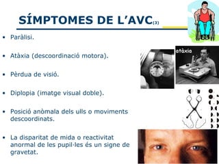 SÍMPTOMES DE L’AVC                     (3)



• Paràlisi.


• Atàxia (descoordinació motora).


• Pèrdua de visió.


• Diplopia (imatge visual doble).


• Posició anòmala dels ulls o moviments
  descoordinats.


• La disparitat de mida o reactivitat
  anormal de les pupil·les és un signe de
  gravetat.
 