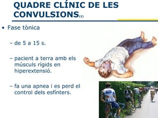 QUADRE CLÍNIC DE LES
    CONVULSIONS               (2)



• Fase tònica

  – de 5 a 15 s.

  – pacient a terra amb els
    músculs rígids en
    hiperextensió.

  – fa una apnea i es perd el
    control dels esfínters.
 