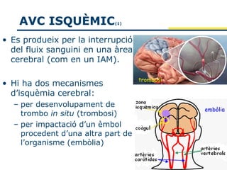 AVC ISQUÈMIC            (1)



• Es produeix per la interrupció
  del fluix sanguini en una àrea
  cerebral (com en un IAM).

                                    trombosi
• Hi ha dos mecanismes
  d’isquèmia cerebral:
  – per desenvolupament de
                                               embòlia
    trombo in situ (trombosi)
  – per impactació d’un èmbol
    procedent d’una altra part de
    l’organisme (embòlia)
 