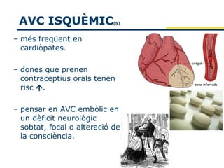 AVC ISQUÈMIC               (5)



– més freqüent en
  cardiòpates.

– dones que prenen
  contraceptius orals tenen
  risc .

– pensar en AVC embòlic en
  un dèficit neurològic
  sobtat, focal o alteració de
  la consciència.
 