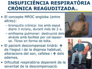 INSUFICIÈNCIA RESPIRATÒRIA
    CRÒNICA REAGUDITZADA                    (2)




• El concepte MPOC engloba (entre
  altres):
  – bronquitis crònica: tos amb esput
    diaris 3 m/any, durant més de 2 a.
  – emfisema pulmonar: destrucció dels
    alvèols amb facilitat per col·lapsar-
    se. Tòrax en forma de bóta.
• El pacient descompensat tindrà: 
  de l’esput i de la dispnea habitual,
  alteracions del son, cefalea i  dels
  edemes.
• Dificultat respiratòria depenent de la
  severitat de la descompensació.
 
