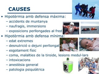 CAUSES
• Hipotèrmia amb defensa màxima:
  – accidents de muntanya
  – naufragis, immersions
  – exposicions perllongades al fred
• Hipotèrmia amb defensa mínima:
  –   edat extremes
  –   desnutrició o dejuni perllongat
  –   esgotament físic
  –   coma, malalties de la tiroide, lesions medul·lars
  –   intoxicacions
  –   anestèsia general
  –   patologia psiquiàtrica
 