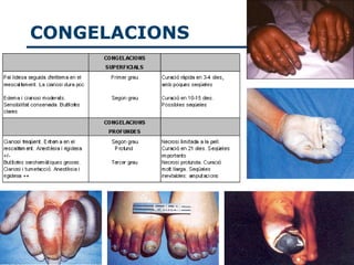 CONGELACIONS
 