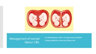 CBL Management of labour.pdf