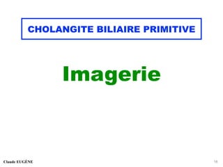 CHOLANGITE BILIAIRE PRIMITIVE
Imagerie
Claude EUGÈNE 18
 