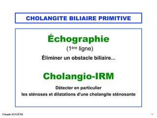 CHOLANGITE BILIAIRE PRIMITIVE
Échographie
(1ère ligne)
Éliminer un obstacle biliaire...
Cholangio-IRM
Détecter en particulier
les sténoses et dilatations d'une cholangite sténosante
Claude EUGÈNE 19
 