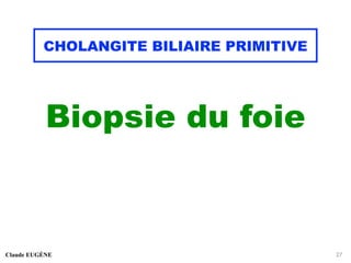 CHOLANGITE BILIAIRE PRIMITIVE
Biopsie du foie
Claude EUGÈNE 27
 