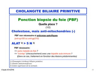 CHOLANGITE BILIAIRE PRIMITIVE
Ponction biopsie du foie (PBF)
Quelle place ?
(1/2)
Cholestase, mais anti-mitochondries (-)
PBF non nécessaire si anticorps spécifiques
(anti-sp100 ou anti-gp210)
ALAT 2) > 5 N 3)
PBF nécessaire:
=> autre maladie du foie ?
=> "overlap" (chevauchement) avec une hépatite auto-immune ?
(Dans ce cas, traitement en fonction des lésions prédominantes)
.......................................................................................................................................
1) Chonangite (cirrhose) biliaire primitive.
2) Alanine aminotransferase.
3) Limite supérieure de la normale.
Claude EUGÈNE 28
 