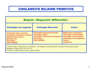 CHOLANGITE BILIAIRE PRIMITIVE
Claude EUGÈNE 30
Biopsie / Diagnostic différentiel 1)
Cholangite non suppurée Cholangite fibrosante Autres
Cholangite biliaire primitive
Cholangite sclérosante primitive
Hépatite auto-immune
Médicaments
Sarcoïdose
Déficit ABCB4
Cholangite sclérosante primitive
Cholangite à IgG4
Cholangite sclérosante secondaire 2)
Sarcoïdose
Déficit ABCB4
Mastocytose systémique
Cholangite neutrophilique
Cholangite à éosinophiles
Histiocytose de Langherans
Cancer
Lymphome
1) D'après EASL Clinical Practice Guidelines : The diagnosis and management of patients with primary biliary
cholangitis J Hepatol 2017;67:145-172.
2) Lithiase, ischémie (état de choc), infection (VIH).
 