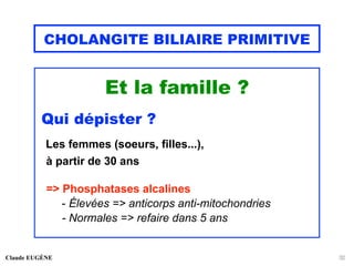 CHOLANGITE BILIAIRE PRIMITIVE
Et la famille ?
Qui dépister ?
Les femmes (soeurs, filles...),
à partir de 30 ans
=> Phosphatases alcalines
- Élevées => anticorps anti-mitochondries
- Normales => refaire dans 5 ans
Claude EUGÈNE 32
 
