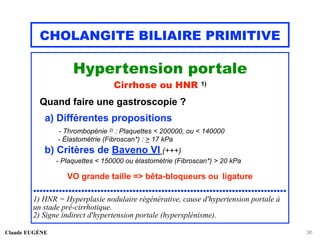 CHOLANGITE BILIAIRE PRIMITIVE
Hypertension portale
Cirrhose ou HNR 1)
Quand faire une gastroscopie ?
a) Différentes propositions
- Thrombopénie 2) : Plaquettes < 200000, ou < 140000
- Élastométrie (Fibroscan*) : > 17 kPa
b) Critères de Baveno VI (+++)
- Plaquettes < 150000 ou élastométrie (Fibroscan*) > 20 kPa
VO grande taille => bêta-bloqueurs ou ligature
...............................................................................
1) HNR = Hyperplasie nodulaire régénérative, cause d'hypertension portale à
un stade pré-cirrhotique.
2) Signe indirect d'hypertension portale (hypersplénisme).
Claude EUGÈNE 36
 