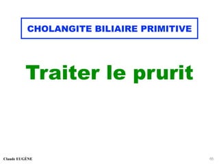 CHOLANGITE BILIAIRE PRIMITIVE
Traiter le prurit
Claude EUGÈNE 65
 