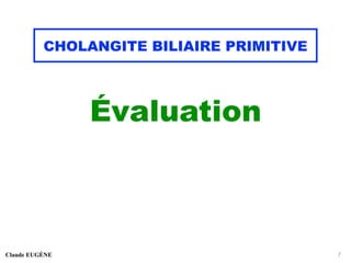 CHOLANGITE BILIAIRE PRIMITIVE
Évaluation
Claude EUGÈNE 7
 