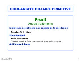 CHOLANGITE BILIAIRE PRIMITIVE
Prurit
Autres traitements
Inhibiteurs sélectifs de la recapture de la sérotonine
Sertraline 75 à 100 mg
Phenobarbital
Effets secondaires
Sédation, majore le déficit en vitamine D, hypertrophie gingivale
Anti-histaminiques
Claude EUGÈNE 74
 