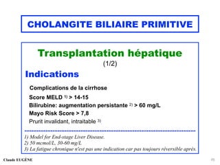 CHOLANGITE BILIAIRE PRIMITIVE
Transplantation hépatique
(1/2)
Indications
Complications de la cirrhose
Score MELD 1) > 14-15
Bilirubine: augmentation persistante 2) > 60 mg/L
Mayo Risk Score > 7,8
Prurit invalidant, intraitable 3)
..................................................................................................
1) Model for End-stage Liver Disease.
2) 50 mcmol/L, 30-60 mg/L
3) La fatigue chronique n'est pas une indication car pas toujours réversible après.
Claude EUGÈNE 76
 