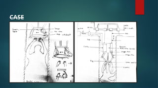 Innovative Multi-Technique Rescue Device for Borewell Emergencies | PPTX