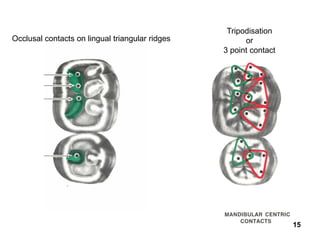 C&b+pk thomas+technique+ver2 | PDF