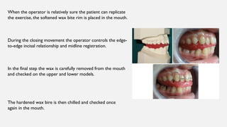 Concepts of bite registration in orthodontics | PPTX