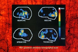 PET (positron emission tomography) scan
 
