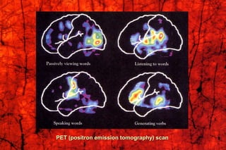 PET (positron emission tomography) scan
 