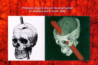 Phineas Gage’s lesion reconstructed
(H. Damasio and R. Frank, 1992)
 