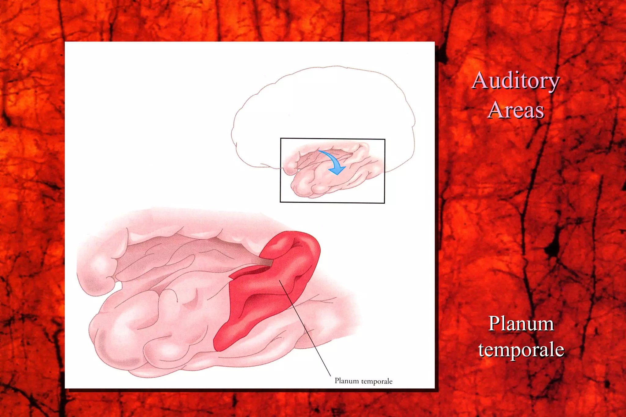 Auditory Areas Planum temporale 
