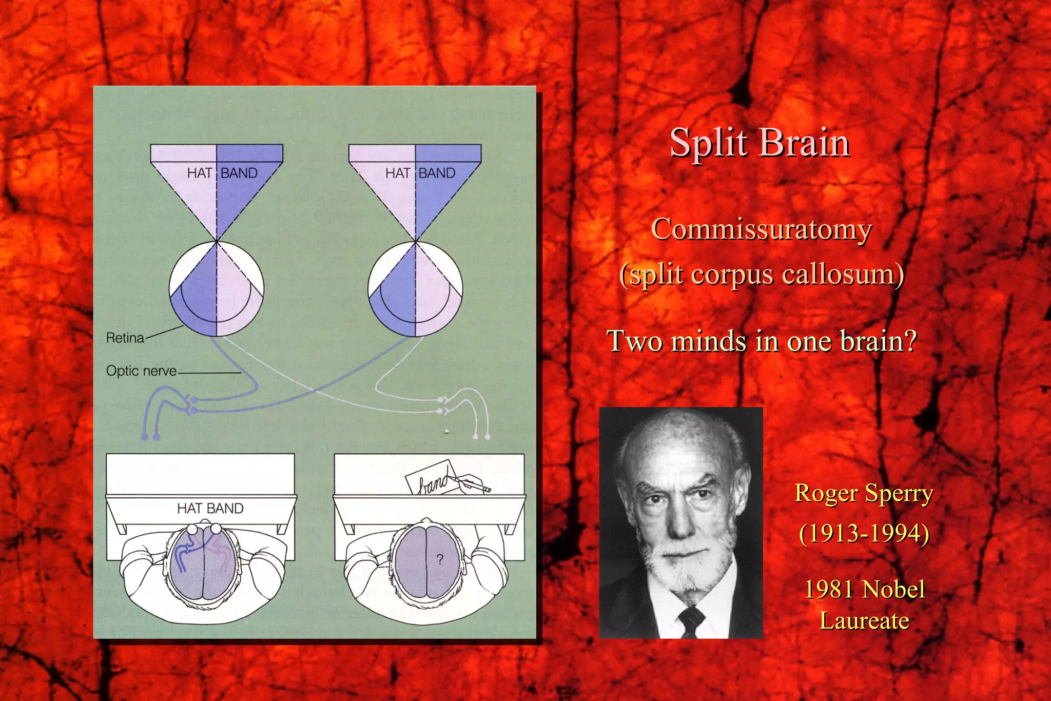 Roger Sperry (1913-1994) 1981 Nobel Laureate Split Brain Commissuratomy (split corpus callosum) Two minds in one brain?                                              