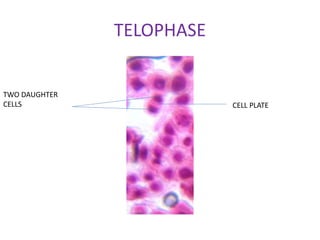 TELOPHASE
CELL PLATE
TWO DAUGHTER
CELLS
 