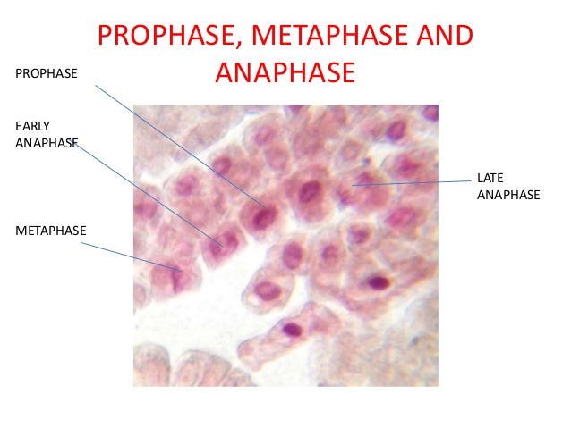 Cbse Class 12 Mitosis Onion Root Tip