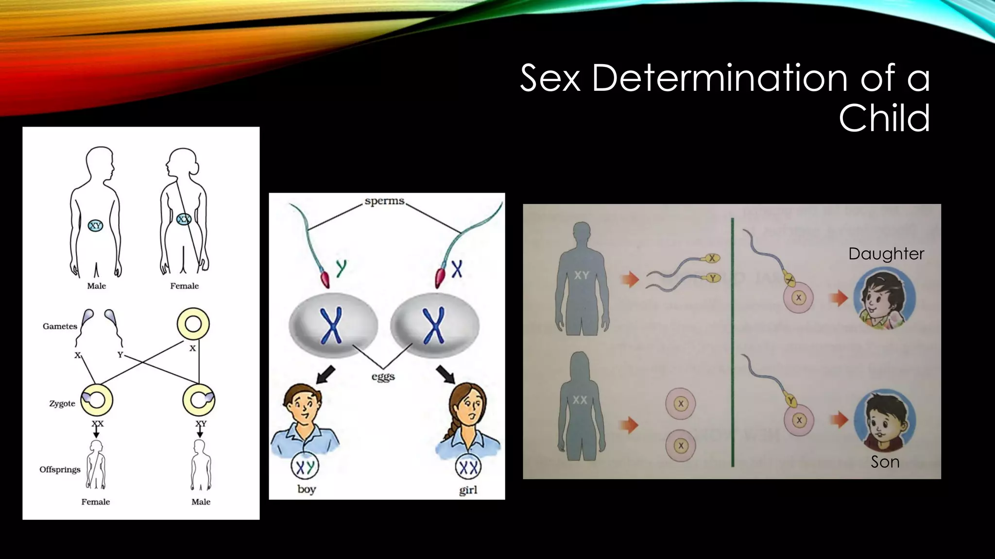 Sex Determination of a
Child
Daughter
Son
 