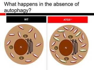 What happens in the absence of
autophagy?
WT ATG5-/-
NL
L
L
NL
L
L
 
