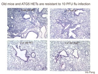 6 wk old WT
2 yr old WT
1 yr old WT
1 yr old Atg5+/-
Iris Pang
Old mice and ATG5 HETs are resistant to 10 PFU flu infection
 
