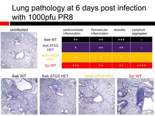 Lung pathology at 6 days post infection
with 1000pfu PR8
peribronchiolar
inflammation
Perivascular
inflammation
alveolitis Lymphoid
aggregates
6wk WT ++ ++ +++ -
6wk ATG5
HET
+ ++ ++ -
8mth ATG5
HET
++ + + -
2yr WT +++ ++ ++ ++++
6wk WT 6wk ATG5 HET 8mth ATG5 HET 2yr WT
uninfected
 
