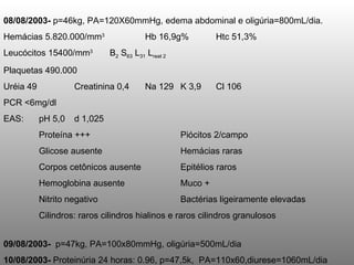 08/08/2003-  p=46kg, PA=120X60mmHg, edema abdominal e oligúria=800mL/dia.  Hemácias 5.820.000/mm 3 Hb 16,9g% Htc 51,3% Leucócitos 15400/mm 3 B 2  S 63  L 31  L reat 2 Plaquetas 490.000 Uréia 49 Creatinina 0,4 Na 129  K 3,9  Cl 106   PCR <6mg/dl EAS: pH 5,0 d 1,025 Proteína +++ Piócitos 2/campo Glicose ausente Hemácias raras Corpos cetônicos ausente Epitélios raros Hemoglobina ausente Muco + Nitrito negativo Bactérias ligeiramente elevadas Cilindros: raros cilindros hialinos e raros cilindros granulosos 09/08/2003-  p=47kg, PA=100x80mmHg, oligúria=500mL/dia 10/08/2003-  Proteinúria 24 horas: 0.96, p=47,5k,  PA=110x60,diurese=1060mL/dia 