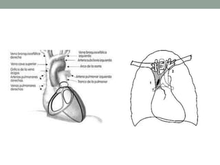 Edema pulmonar: Abordaje  diagnósticoN Engl J Med 2005;353:2788-96.